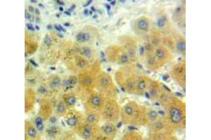 IHC-P analysis of Liver tissue, with DAB staining. (GDF7 抗体  (AA 295-447))