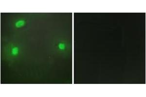 Immunofluorescence analysis of HeLa cells, using FEN1 Antibody. (FEN1 抗体  (AA 86-135))