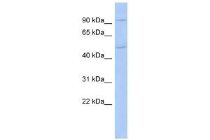 WB Suggested Anti-CXorf6 Antibody Titration:  0. (MAMLD1 抗体  (N-Term))