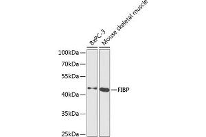 Western blot analysis of extracts of various cell lines, using FIBP antibody  at 1:1000 dilution. (FIBP 抗体  (AA 1-364))