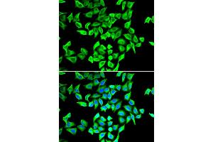 Immunofluorescence analysis of A549 cells using TP53 antibody (ABIN5970093). (p53 抗体)