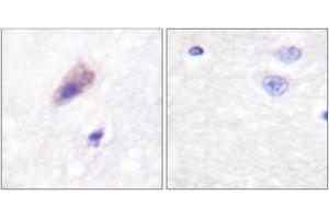 Immunohistochemistry analysis of paraffin-embedded human brain, using Dynamin-1 (Phospho-Ser774) Antibody. (Dynamin 1 抗体  (pSer774))