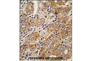 Immunohistochemistry (Paraffin-embedded Sections) (IHC (p)) image for anti-Transient Receptor Potential Cation Channel, Subfamily M, Member 8 (TRPM8) (AA 926-956), (C-Term) antibody (ABIN392821)
