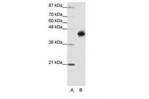 Image no. 1 for anti-Keratin 18 (KRT18) (N-Term) antibody (ABIN203131) (Cytokeratin 18 抗体  (N-Term))