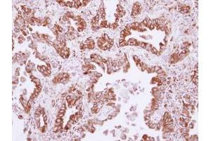Image no. 1 for anti-NudC Domain Containing 1 (NUDCD1) (AA 332-583) antibody (ABIN1499850) (NUDCD1 抗体  (AA 332-583))