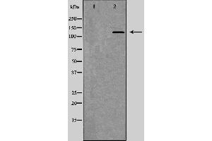 Western blot analysis of Mouse spleen lysate, using ITGAM Antibody. (CD11b 抗体  (Internal Region))