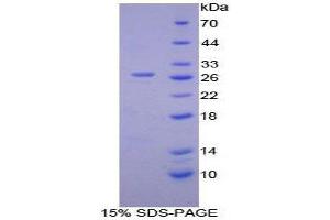 SDS-PAGE (SDS) image for Calcium/calmodulin-Dependent Protein Kinase II gamma (CAMK2G) (AA 75-281) protein (His tag) (ABIN1879729) (CAMKII gamma Protein (AA 75-281) (His tag))