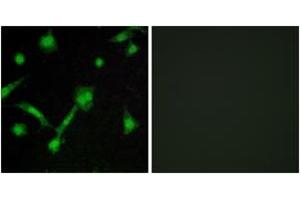 Immunofluorescence analysis of LOVO cells, using IkappaB-alpha (Phospho-Ser32/Ser36) Antibody. (NFKBIA 抗体  (pSer32))