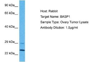 Host: Rabbit Target Name: BASP1 Sample Tissue: Human Ovary Tumor Antibody Dilution: 1ug/ml