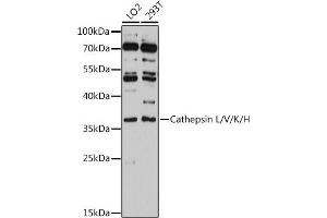 Western blot analysis of extracts of various cell lines, using Cathepsin L/V/K/H antibody (ABIN6127670, ABIN6139235, ABIN6139237 and ABIN6215636) at 1:3000 dilution. (Cathepsin L 抗体  (AA 114-333))