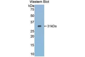Western blot analysis of recombinant Mouse TOLLIP. (TOLLIP 抗体  (AA 19-254))