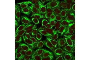 Confocal immunofluorescence image of HeLa cells using Cytokeratin 8 Mouse Monoclonal Antibody (K8/383). (KRT8 抗体)