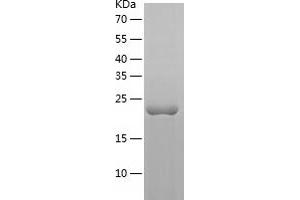 Western Blotting (WB) image for Spermidine/Spermine N1-Acetyltransferase 2 (SAT2) (AA 1-190) protein (His tag) (ABIN7125190) (SAT2 Protein (AA 1-190) (His tag))
