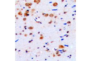 Immunohistochemical analysis of CUGBP1 staining in human brain formalin fixed paraffin embedded tissue section. (CELF1 抗体  (Center))