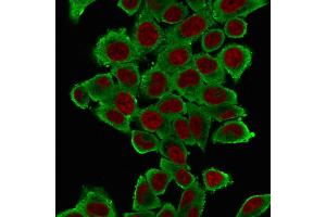 Immunofluorescence (IF) image for anti-Actin, alpha 2, Smooth Muscle, Aorta (ACTA2) (N-Term) antibody (ABIN6940518)