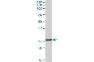 CTRB1 MaxPab polyclonal antibody. (CTRB1 抗体  (AA 1-263))