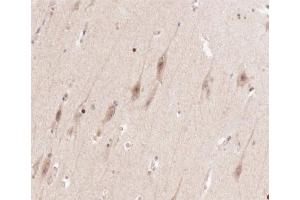 ABIN6266602 at 1/100 staining human brain tissue sections by IHC-P. (ENO2/NSE 抗体  (C-Term))