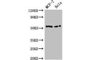 Western Blot Positive WB detected in: MCF-7 whole cell lysate, Hela whole cell lysate All lanes: PTK6 antibody at 2. (PTK6 抗体  (AA 1-113))