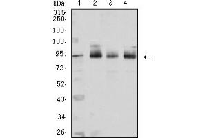 Western Blotting (WB) image for anti-Catenin (Cadherin-Associated Protein), beta 1, 88kDa (CTNNB1) (AA 1-100) antibody (ABIN5611272)