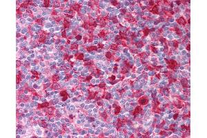 Anti-SYK antibody IHC of human tonsil. (SYK 抗体  (AA 5-360))