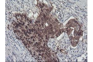 Image no. 10 for anti-Aminoacylase 1 (ACY1) antibody (ABIN1496455)