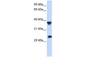 Western Blotting (WB) image for anti-Atonal Homolog 1 (Drosophila) (ATOH1) (Middle Region) antibody (ABIN2779592)