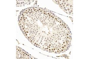 Immunohistochemistry of paraffin embedded rat testis using SCP1 (ABIN7075786) at dilution of 1:500 (300x lens) (SYCP1 抗体)