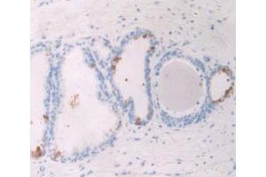 IHC-P analysis of Human Prostate Gland Tissue, with DAB staining. (GREM1 抗体  (AA 26-184))