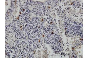 Immunoperoxidase of monoclonal antibody to TPSAB1 on formalin-fixed paraffin-embedded human lymph node. (TPSAB1 抗体  (AA 1-275))