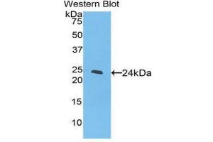 Western Blotting (WB) image for anti-Peroxisome Proliferator-Activated Receptor gamma (PPARG) (AA 311-500) antibody (ABIN3207607) (PPARG 抗体  (AA 311-500))