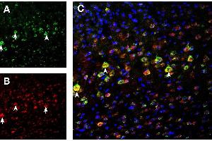 Multiplex staining of NMDA3B and NMDAR1 in mouse cortex.