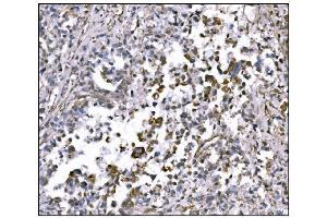 IHC analysis of NDEL1 using anti-NDEL1 antibody (ABIN7602511). (NDEL1 抗体  (AA 80-320))