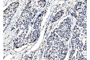 IHC analysis of DLX2 using anti-DLX2 antibody (ABIN7599936). (DLX2 抗体  (AA 13-310))
