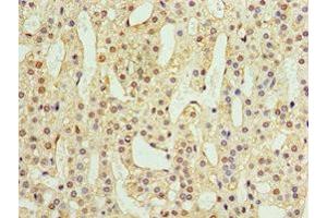 Immunohistochemistry of paraffin-embedded human adrenal gland tissue using ABIN7144559 at dilution of 1:100 (ADAP1 抗体  (AA 1-374))