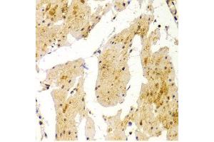 Immunohistochemistry of paraffin-embedded Human esophageal using MVP antibody at dilution of 1:100 (x400 lens). (MVP 抗体  (AA 1-260))