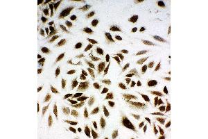 Immunohistochemistry (IHC) image for anti-Non-Metastatic Cells 1, Protein (NM23A) Expressed in (NME1) (AA 137-152), (C-Term) antibody (ABIN3044197)