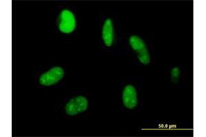 Immunofluorescence of purified MaxPab antibody to ZNF331 on HeLa cell. (ZNF331 抗体  (AA 1-463))