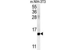 Western Blotting (WB) image for anti-Cellular Retinoic Acid Binding Protein 1 (CRABP1) antibody (ABIN3002339) (CRABP1 抗体)