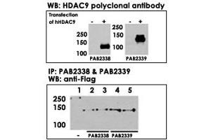 Both HDAC9  and HDAC9  polyclonal antibody were tested by WB and IP-WB using HeLa and HeLa-HDAC9 transfected cells. (HDAC9 抗体  (N-Term))
