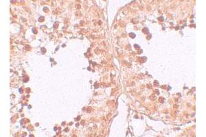Immunohistochemical staining of human testis cells with CRISP2 polyclonal antibody  at 10 ug/mL. (CRISP2 抗体  (N-Term))