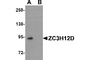 Western blot analysis of ZC3H12D in THP-1 cell lysate with ZC3H12D antibody at 1 µg/mL in (A) the absence and (B) the presence of blocking peptide. (ZC3H12D 抗体  (C-Term))