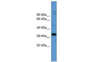 ADORA2B antibody used at 0.