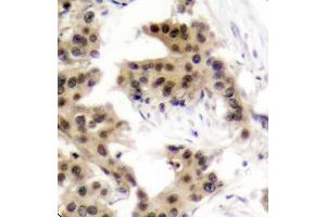 Immunohistochemistry (IHC) image for anti-Nuclear Factor of kappa Light Polypeptide Gene Enhancer in B-Cells 1 (NFKB1) (pSer893) antibody (ABIN1870468) (NFKB1 抗体  (pSer893))