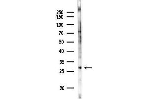 anti-RAB27A, Member RAS Oncogene Family (RAB27A) (C-Term) antibody