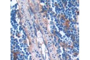 Immunohistochemistry (IHC) image for anti-Proto-Oncogene Pim-2 (Serine Threonine Kinase) (PIM2) (AA 34-292) antibody (ABIN1860223)
