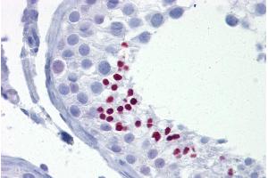 Immunohistochemistry with Testis tissue at an antibody concentration of 5µg/ml using anti-TLE4 antibody (ARP32381_P050) (TLE4 抗体  (N-Term))