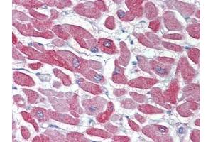 Heart, Human: Formalin-Fixed, Paraffin-Embedded (FFPE)