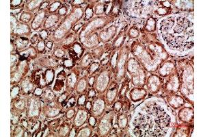 Immunohistochemistry (IHC) image for anti-IMP3, U3 Small Nucleolar Ribonucleoprotein (IMP3) (AA 135-184) antibody (ABIN7189445)
