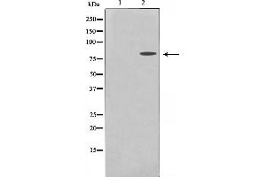 Western blot analysis on MDA-MB-435 cell lysate using MMP15 Antibody. (MMP15 抗体  (C-Term))