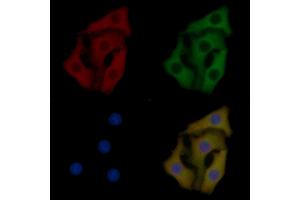 Profilin 1 Mouse Monoclonal Antibody staining Hela cells by IF/ICC. (PFN1 抗体)
